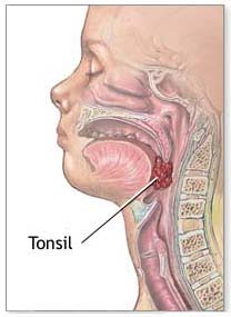 tonsil diagram